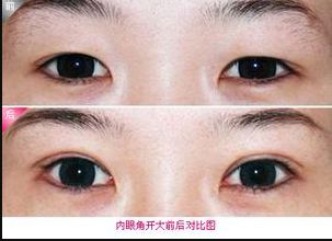 廊坊地區(qū)瘦臉針醫(yī)院排行榜2023：哪家醫(yī)院的瘦臉針效果好？