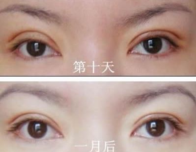 長春哪家醫(yī)院治痘痘好？了解長春市治療青春痘的?？漆t(yī)院及價格