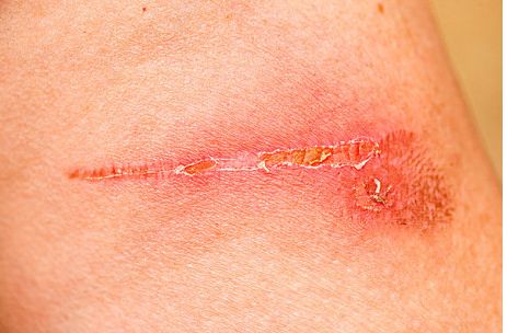 廣州整形醫(yī)院去哪家好？權(quán)威排行榜及患者口碑評價對比！