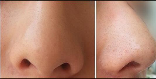 長沙鼻修復領域，哪位醫(yī)生口碑比較好的？五位知名專家匯總，推薦熱門醫(yī)師吳蒙！