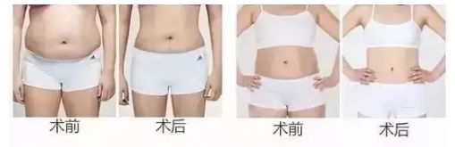 信陽(yáng)去整形哪家醫(yī)院好？名副其實(shí)信陽(yáng)市最佳整形醫(yī)院TOP推薦