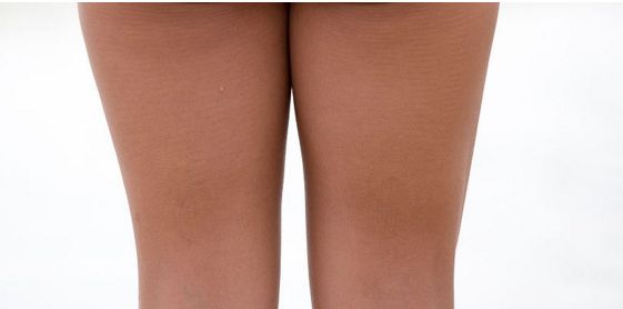 杭州治疤痕那個醫(yī)院好？解析杭州治疤痕醫(yī)院榜單