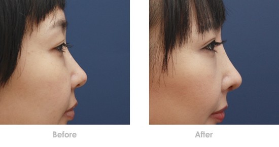 2023四川痘印點(diǎn)陣激光正規(guī)專(zhuān)家評(píng)分TOP10(郁梅、彭忠、柏雨青都是當(dāng)?shù)貎?yōu)質(zhì)專(zhuān)家)