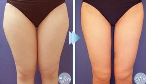 如何選擇最適合您的除腋臭治療醫(yī)院？全國哪家醫(yī)院好？