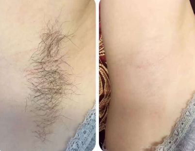 上海整形醫(yī)院哪家的好？最權(quán)威的排名榜單來幫你挑選！