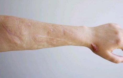 鄭州整形醫(yī)科醫(yī)院哪家好？尋找鄭州整形專業(yè)醫(yī)院推薦