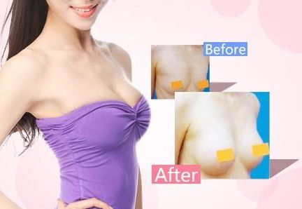 天津哪家醫(yī)院去疤痕好？專業(yè)醫(yī)生推薦的天津去疤痕頂級醫(yī)院有哪些？