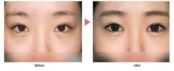 珠海整形醫(yī)院去哪家好？挑選術(shù)前評(píng)價(jià)好的整形醫(yī)院，放心修復(fù)您的美麗