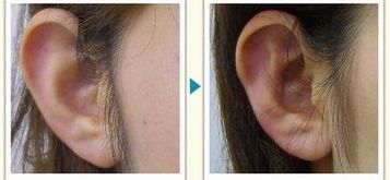 成都燒傷整形醫(yī)院哪家好？燒傷康復中心排名TOP5，專家支招！