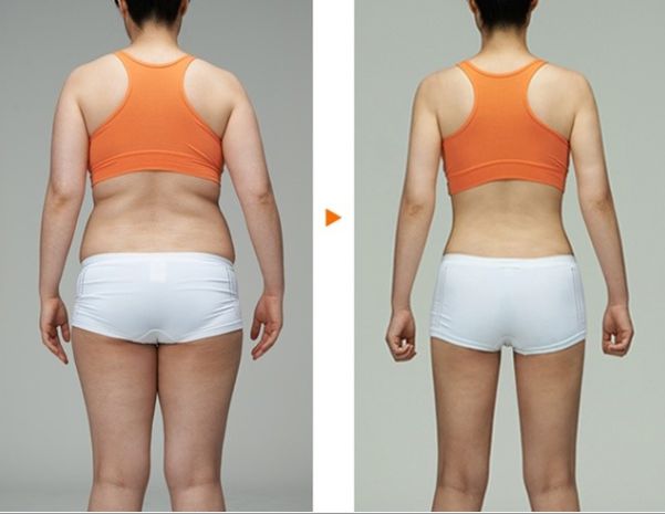 南京吸脂瘦臉哪家醫(yī)院好？全面解析南京吸脂手術(shù)的醫(yī)院排名及選擇攻略