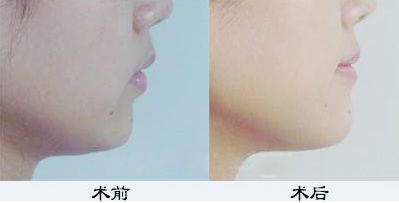 鄭州鼻綜合哪家醫(yī)院好？TOP醫(yī)療機構(gòu)大揭秘