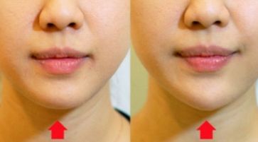 南京整容手術(shù)最靠譜的醫(yī)院排行榜，告訴你南京做整容手術(shù)醫(yī)院哪家好