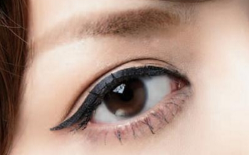 貴陽雙眼皮整形醫(yī)生推薦：劉德東、徐威、陳誠等技術可靠！