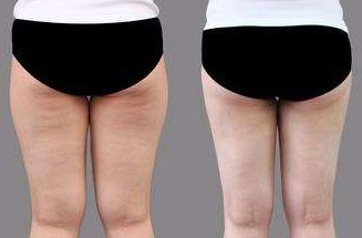 菏澤市整形醫(yī)院哪家好？排名榜單發(fā)布