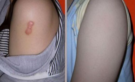 上海雙眼皮切開手術(shù)，哪家醫(yī)院技術(shù)好且安全？