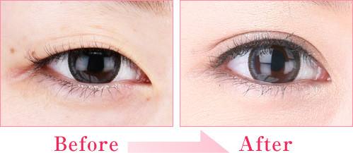 2023蘇州微針去除抬頭紋醫(yī)生前十名排名榜(王艷、魏聆、李郯軍知名度很高)