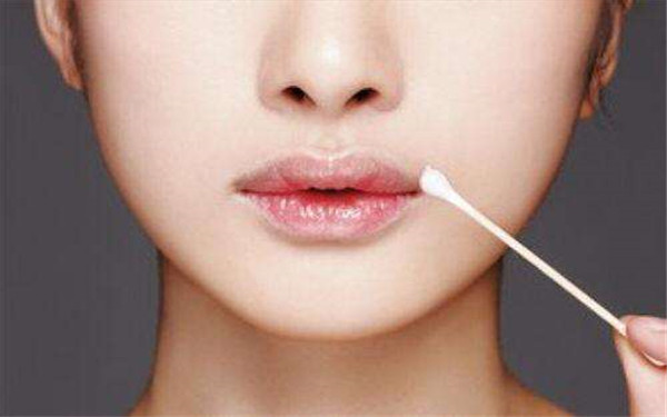 2023廣州除皺針去木偶紋正規(guī)醫(yī)生評(píng)分TOP10(楊權(quán)明、柳霞、丁莉美知名度很高)