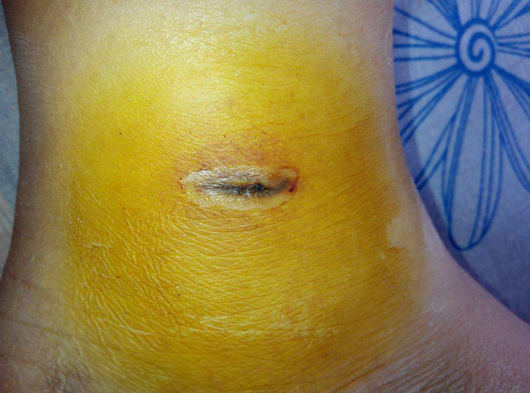 2023南京肋骨鼻基底填充醫(yī)生前10位上榜名單(胡曉慶、???(尹治鐛)、陳天杰技術(shù)和安全有保障)