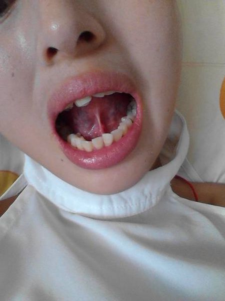 2023昆明填充自體脂肪正規(guī)醫(yī)生推薦前十位(毛志堅、楊恰佳、胡霞口碑評價好)