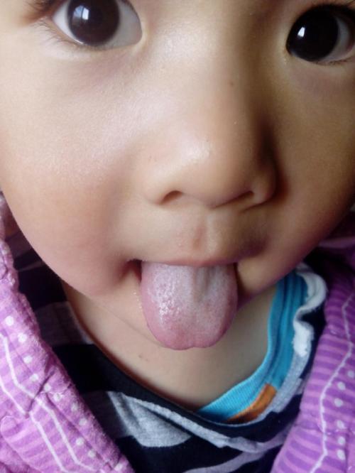 2023湛江玻尿酸聯(lián)合注射除皺抗衰正規(guī)專家評(píng)價(jià)前10位(鐘貴紅、陳審、李興均評(píng)價(jià)都是好的)