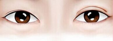 上海哪家醫(yī)院擅長激光治療？