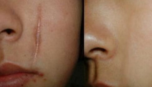 烏魯木齊眼袋手術(shù)專家推薦，哪家醫(yī)院好？