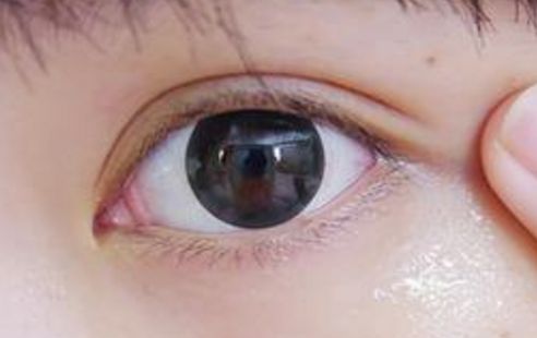 上海激光美白醫(yī)院排行榜及綜合評(píng)價(jià)