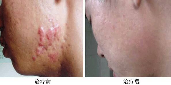 南京哪家醫(yī)院做兔唇手術(shù)效果好又安全？