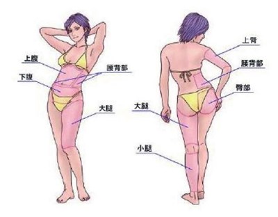 2023南京消除生長(zhǎng)紋術(shù)口碑排名前十位醫(yī)生(W.杰甫林、申汶錫、王春娟看完口碑、價(jià)格這些對(duì)比后見(jiàn)分曉)