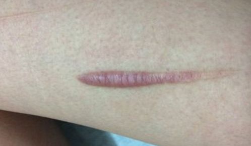 湘潭市美容哪家醫(yī)院好？探尋專家推薦，找到適合你的醫(yī)美機(jī)構(gòu)！