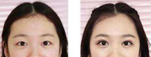 長沙整形科醫(yī)院排名及綜合評價：長沙哪家整形醫(yī)院口碑好？