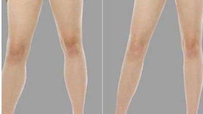 南京埋線醫(yī)院哪家好？權(quán)威專家推薦五家頂級醫(yī)院！