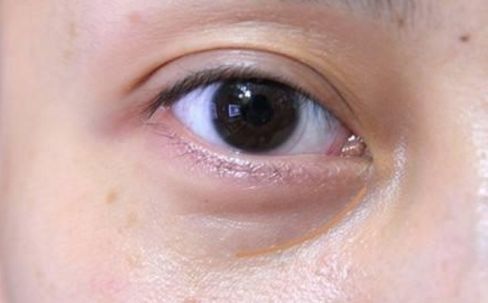 聊城豐胸整形醫(yī)院哪家好？解析引領聊城整形界的最佳選擇