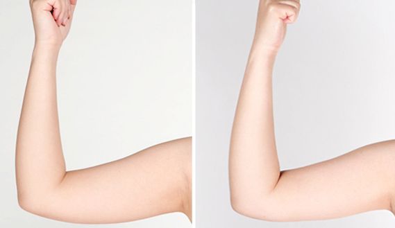 貴陽(yáng)有哪些專業(yè)治療痘印痘坑的醫(yī)院值得推薦？