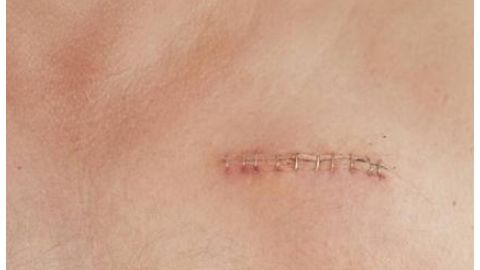 江蘇省中醫(yī)院整形科是否有專業(yè)資質(zhì)？醫(yī)生擅長哪些項(xiàng)目？簡介了解一下！