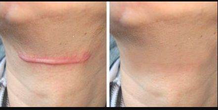 南京取出奧美定哪家好？南京市區(qū)有哪些口碑較好的奧美取出門店？