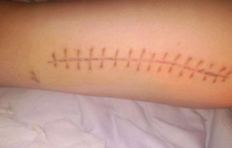 常熟哪家看痘痘醫(yī)院好？專(zhuān)家推薦常熟治療痘痘靠譜的醫(yī)院有哪些？