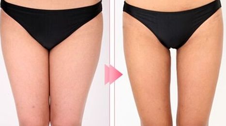 廊坊去斑的醫(yī)院哪家好？推薦您去哪家專業(yè)的醫(yī)院進行去斑治療