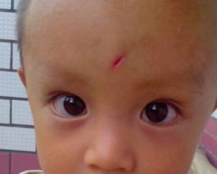 青島童顏線雕提升哪家好？選擇最佳青島童顏線雕醫(yī)院的3個關(guān)鍵因素