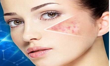 南京哪家醫(yī)院做埋線雙眼皮效果好？