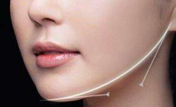 2023杭州法令紋注射填充醫(yī)生口碑榜前十位(鄒霞、孫小應、郭江花口碑點評)