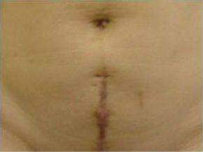 天津祛痘醫(yī)院哪家效果好？為您推薦天津?qū)I(yè)祛痘醫(yī)院排行榜