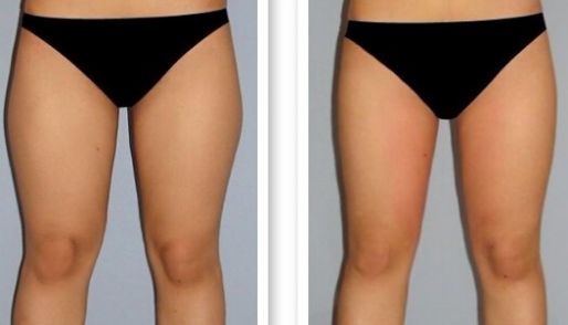 濟南祛痘哪家醫(yī)院技術(shù)好？選擇哪家醫(yī)院更靠譜？