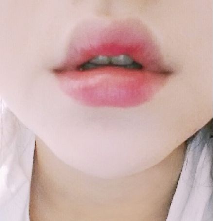 重慶去手術(shù)傷疤哪家醫(yī)院好？探尋重慶專業(yè)治療手術(shù)疤痕的醫(yī)院排名