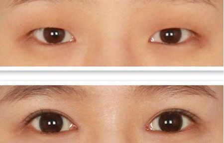 北京整容科好的醫(yī)院有哪些？中關(guān)村整形醫(yī)院綜合實(shí)力領(lǐng)先！