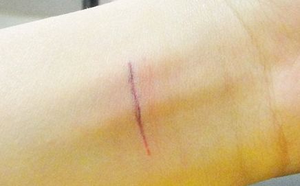 上海哪家隆鼻醫(yī)院好且正規(guī)？優(yōu)質(zhì)咨詢幫助你挑選合適的醫(yī)院