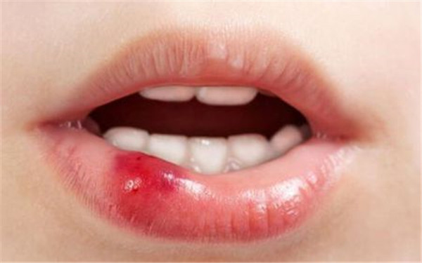 2023貴州祛頸紋嗨體權(quán)威醫(yī)生排名榜前十(魏在榮、張凱、張連洪這份專家名單推薦給你)