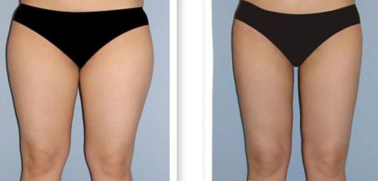 泉州醫(yī)院哪家做手術(shù)好？選泉州醫(yī)院手術(shù)排名榜單