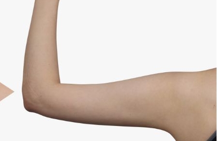 周柯做鼻子的效果及費用分析，醫(yī)生介紹與真實案例揭秘，打造自然又美觀的風格