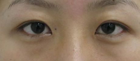 南寧哪家美容整形醫(yī)院口碑好又實惠？